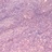 ClearStone