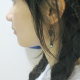 她小北