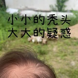 小秃头の老母亲